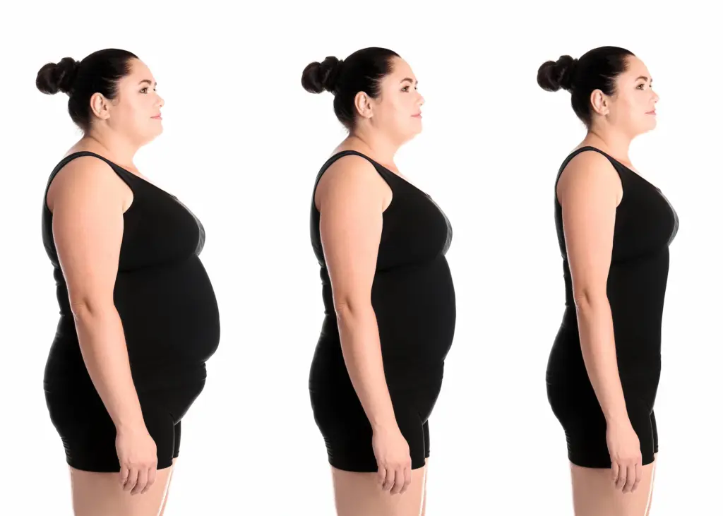 A side view of a woman's transformation and results during her weight loss journey